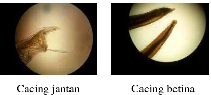 Gambar 2. Cacing Ascaridia galli Jantan dan Betina (Perbesaran 10x)  