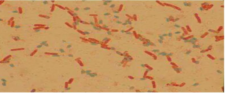 Gambar 2.2 Bakteri Bacillus cereus ( Kotiranta A, et al. 2000) 