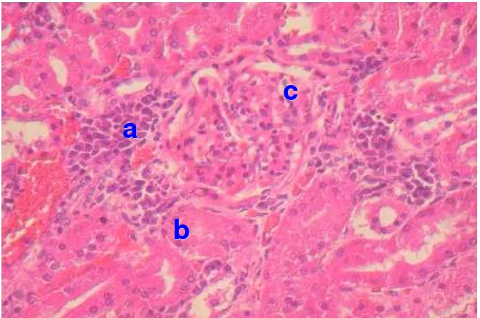 Gambaran histopatologi ginjal di daerah interstitial terlihat sel-sel radang terutama 