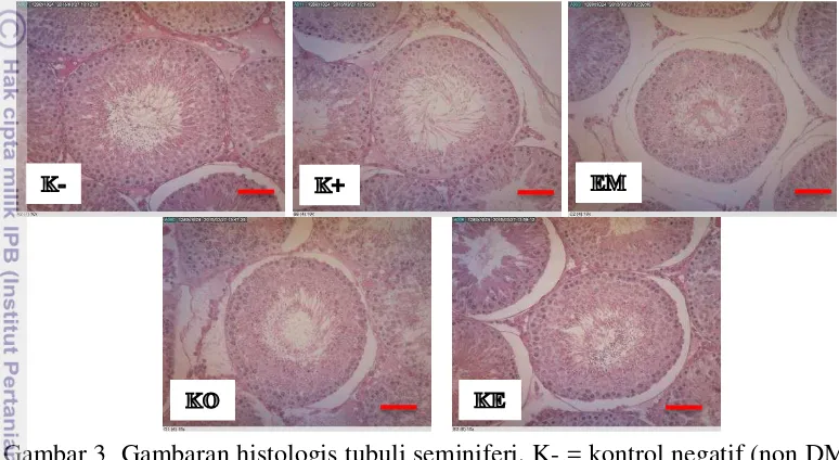 Gambar 3  Gambaran histologis tubuli seminiferi. K- = kontrol negatif (non DM); 