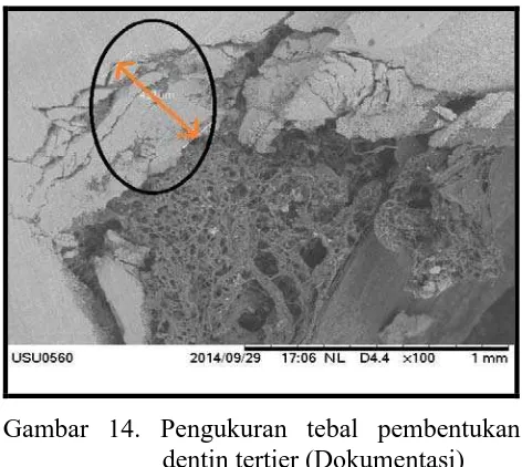 Gambar 14. Pengukuran tebal pembentukan dentin tertier (Dokumentasi) 