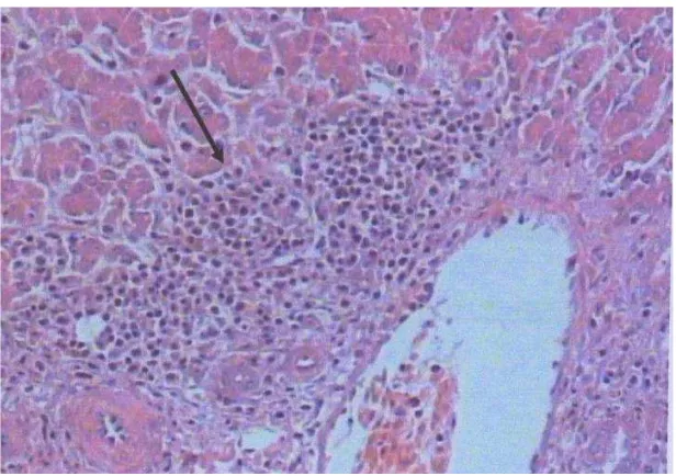 Gambar 7 Fotomikrograf hati ayam yang diinfeksi virus Marek (MDV)                      dosis 0.125 x 103 EID50 pewarnaan Hematoksilin-Eosin (HE)