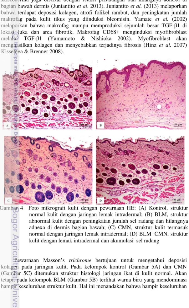 Gambar  4    Foto  mikrografi  kulit  dengan  pewarnaan  HE:  (A)  Kontrol,  struktur  normal  kulit  dengan  jaringan  lemak  intradermal;  (B)  BLM,  struktur  abnormal  kulit  dengan  peningkatan  jumlah  sel  radang  dan  hilangnya  adnexa  di  dermis 