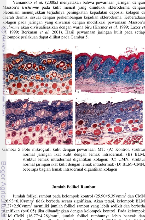 Gambar  5  Foto  mikrografi  kulit  dengan  pewarnaan  MT:  (A)  Kontrol,  struktur  normal  jaringan  ikat  kulit  dengan  lemak  intradermal;  (B)  BLM,  struktur  lemak  intradermal  digantikan  kolagen;  (C)  CMN,  struktur  normal jaringan ikat kulit 