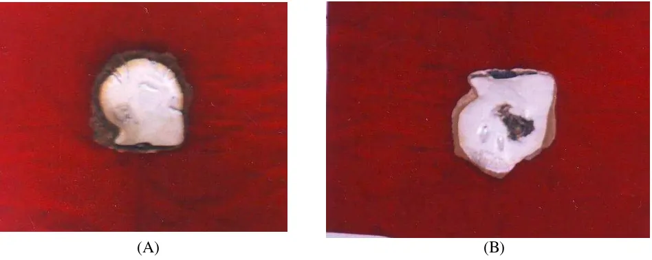 Gambar 3.  Pembentukan blister pada lapisan nacre akibat serangan polikaeta pengebor (A), dan Lubang yang merusak lapisan nacre akibat serangan polikaeta pengebor (B)