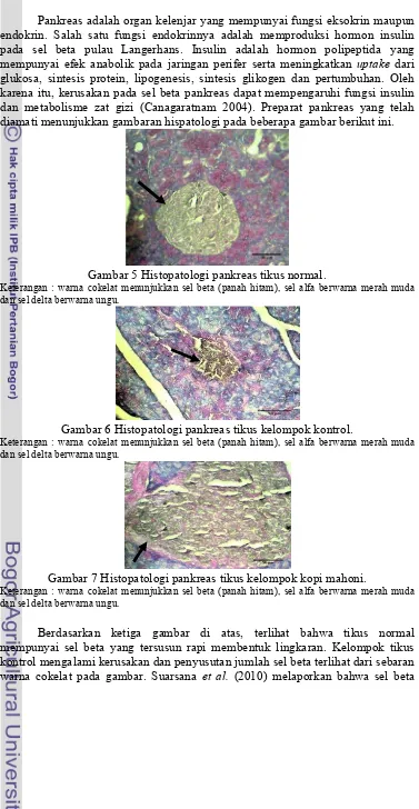 Gambaran Histopatologi Pankreas  