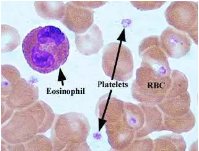 Gambar 2.4. Morfologi eosinofil dari apusan darah tepi 