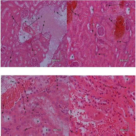 Gambar 17. Struktur histologis tubulus proksimal ginjal mencit jantan yang terpapar                   kebisingan 6 jam/hari (perbesaran 400x, perwarnan HE)