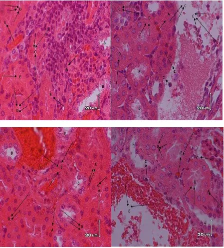 Gambar 18. Struktur histologis tubulus proksimal ginjal mencit jantan yang terpapar            kebisingan 8 jam/hari (perbesaran 400x, perwarnan HE)