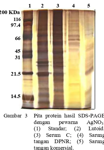 Gambar 3  Pita protein hasil SDS-PAGE 