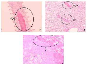 Gambar 7. (A) jaringan insang ikan nila di Situ Cisanti yang mengalami kongesti. (B) jaringan  hati ikan betok di Majalaya yang mengalami kongesti