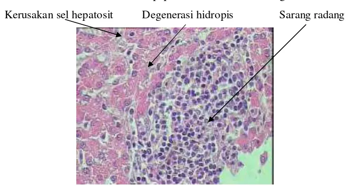 Gambar 4. Gambaran mikroskopis hati broiler yang diberi antibiotik dan diinfeksi  S. typhimurium pada umur 42 hari; pewarnaan HE (pembesaran objektif 40X)