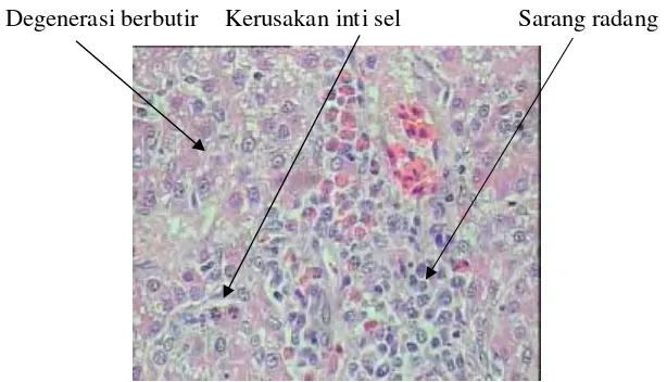 Gambar 5. Gambaran mikroskopis hati broiler yang diberi  L. plantarum dan diinfeksi  S