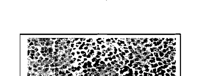 Gambar 4. Payudara pada rnc~lci t perlakuan (perbesaran 400x) 