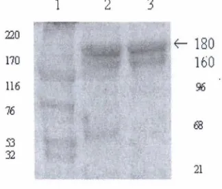 Gambar 2. Kromatogram hasil filtrasi Gel IgY 