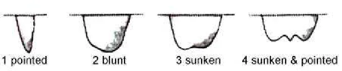 Gambar 8.  Bentuk Ujung Buah: 1. Runcing, 2. Tumpul, 3. Cekung,  