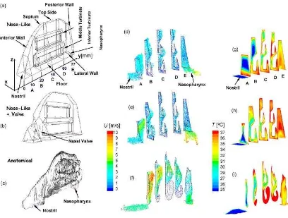 Figure 2.4 The example of simplified 3D model from David Elad study. 