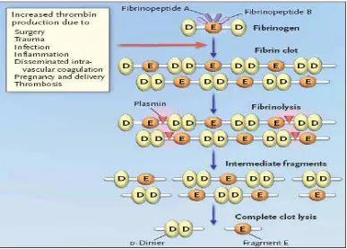 Gambar 2.2.1 Degradasi bekuan fibrin (Bockenstedt P, 2003). 