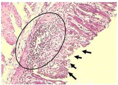 Gambar 4. Histopatologi Ulkus Gaster (Clara et al., 2012). 