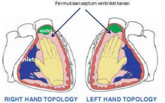 Gambar 3. Topology ventrikel, rigDikutip dari Webber SA9l, right hand ventricular topology dan left hand ventrentricular topology