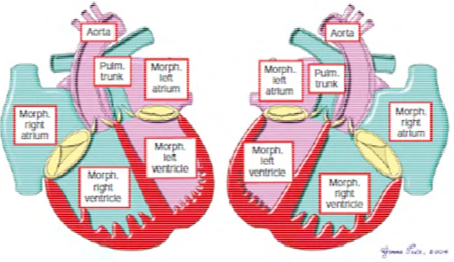 Gambar 5. Sebelah kiri Mirror imagedenganright hand topologyimage dengan left hand topology, sebelah kanan ususual atrial arrangement