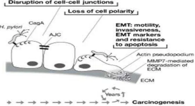 Gambar H. pylori yang berhubungan dengan karsinogenesis melalui CagA yang menginduksi transisi mesenkimal epitel (EMT).32 