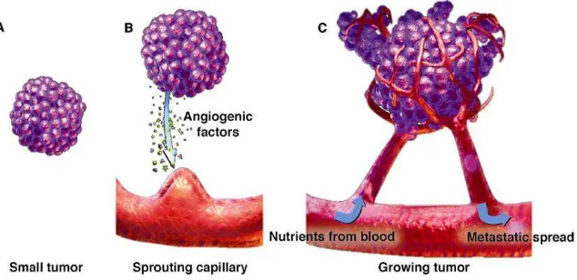 Gambar Pertumbuhan pembuluh darah baru pada tumor 37