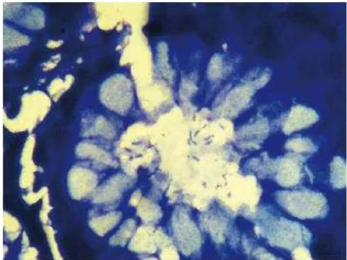 Gambar 2. Biopsi gaster menunjukkan H.pylori dengan pembesaran 1000x (Garg B, et al, 2012) 
