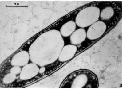 Gambar 2. Granula poli-�-hidroksialkanoat di dalam sel (Lenz dan Marches-sault, 2005) 