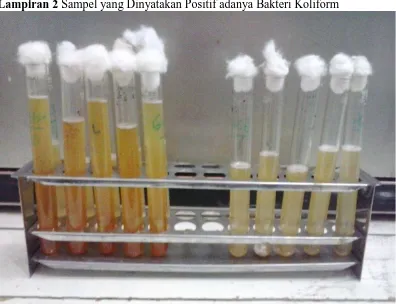 Gambar 3 : Sampel yang telah dinyatakan positif adanya bakteri (Terbentuk gas)  