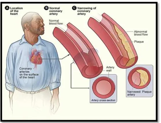 Figure 1: The Structure of artery (Hage et al. 2009) 