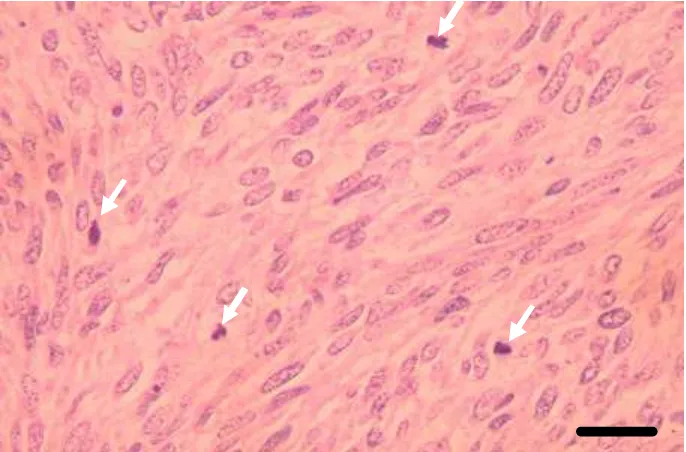 Gambar 7  Gambaran histopatologis sel tumor leiomiosarkoma pada paru-paru disertai figur mitotik (�)