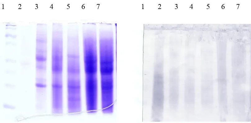 Gambar 6b. Analisis SDS-PAGE berbagai konsentrasi protein transforman kedelai cp-SMV 