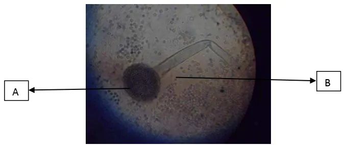 Gambar 4. Penampakan Aspergillus dibawah mikroskop (perbesaran 100 kali)    A. Spora, B