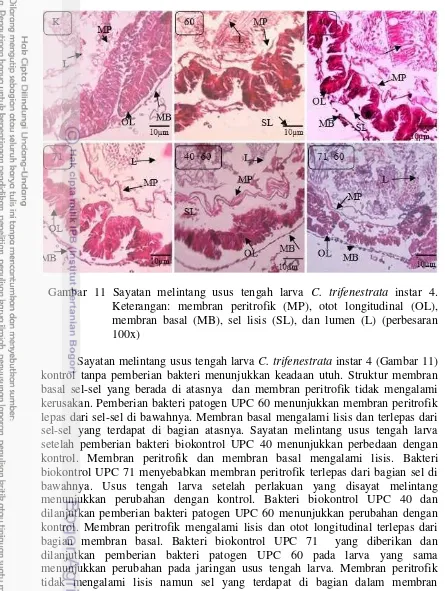 Gambar 11 Sayatan melintang usus tengah larva C. trifenestrata instar 4. 