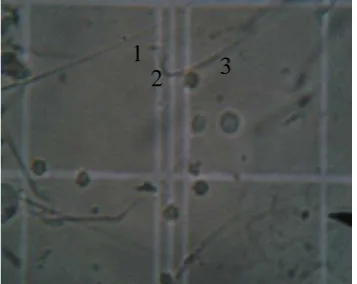 Gambar 4.2.1 Spermatozoa Normal  