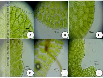 Gambar 8  Bentuk ujung gametofit. A. P. biaurita; B. P. ensiformis; C. P. exelsa;  
