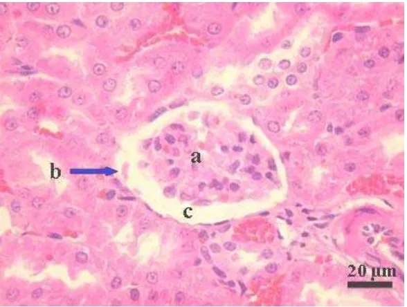 Gambar 4 Glomerulus ginjal tikus dengan endapan protein di mesangium (a), dan di ruang Bowman (b) serta perluasan ruang Bowman (c) pasca pemberian daun A.villosa tidak dikukus selama 4 minggu