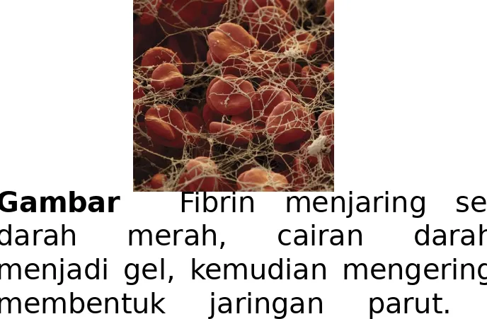 Gambar  Fibrin menjaring sel 