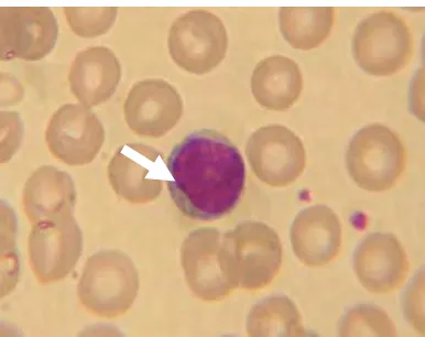 Gambar 5  Sel darah putih (leukosit), limfosit. (Sumber : http://Id.wikipedia.org) 