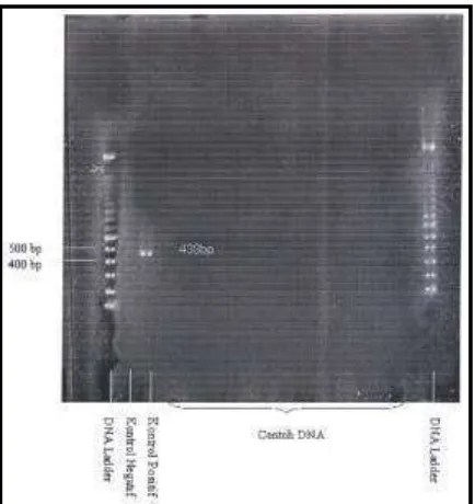Gambar 6  Hasil pengamatan dengan UV transluminator DNA 