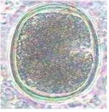 Gambar 3.  Telur Mecistocirrus sp telur berukuran 68-101 x 60-86 