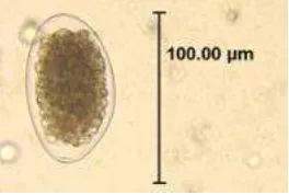 Gambar 5.  Telur Trichostrongylus sp (El-Shazly et al, 2006). 