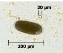 Gambar 6.  Telur Nematodirus sp berukuran 79-117 x 47-70 mikron  