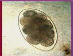Gambar 7.  Telur Oesophagostomum sp berukuran 70-76 x 36-40  