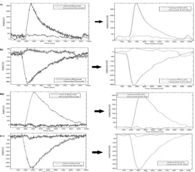 Fig. 2: Unfiltered and Filtered EOG Signals of i) Downward, ii) Upward, iii) Leftward and iv) Rightward, EOG signal plotted using MATLAB