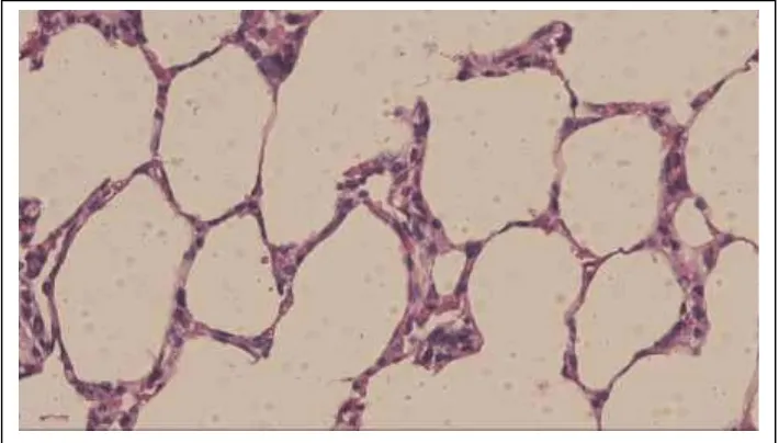Gambar 1 : Pulmo (alveoli) tikus kelompok kontrol (HE, 10x40) 