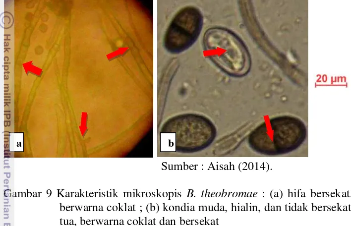 Gambar 9 Karakteristik mikroskopis B. theobromae : (a) hifa bersekat, tua, dan 