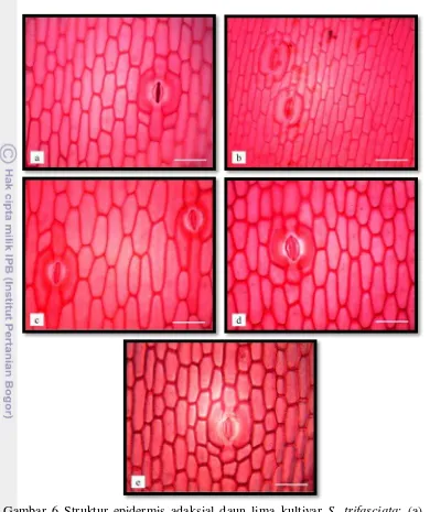 Gambar 6 Struktur epidermis adaksial daun lima kultivar S. trifasciata: (a). S. 