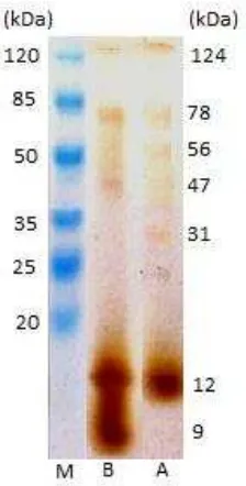 Gambar 12  Profil protein isolat A (lajur A), isolat B (lajur B) 